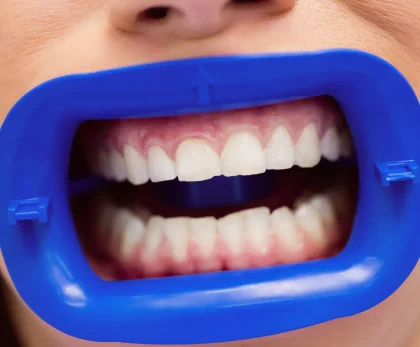 Cost of Full Mouth Dental Implants in Colombia