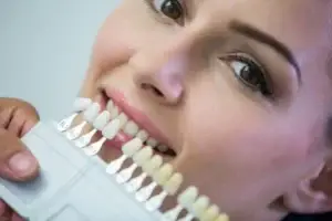 Dental Veneers in Turkey Cost and Clinics