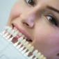 Dental Veneers