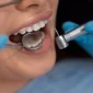 Full Mouth Crowns Cost in Mexico 85x85