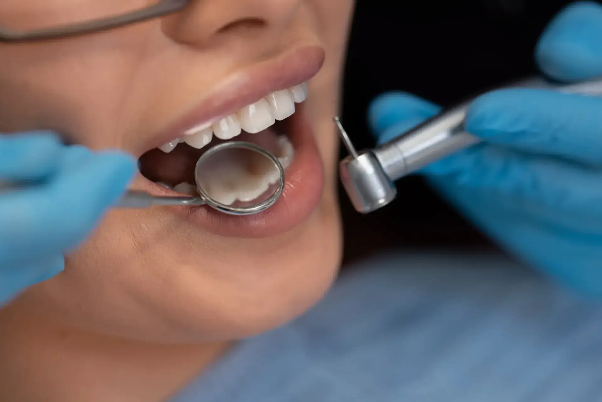 Full Mouth Crowns Cost in Mexico