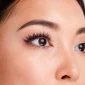 Korea Double Eyelid Surgery Price 85x85