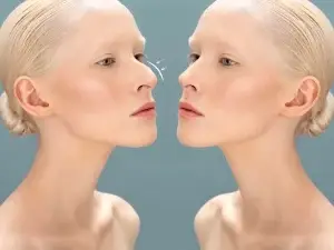 Rhinoplasty in South Korea Cost