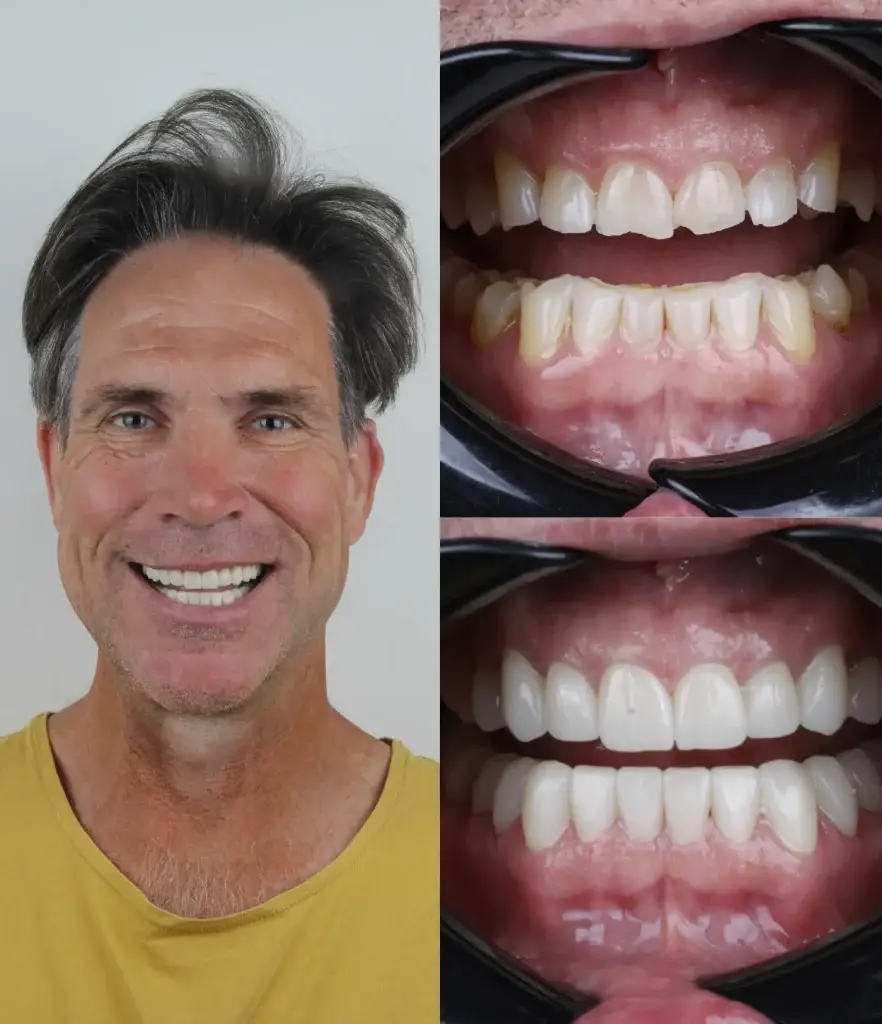 images for before and after