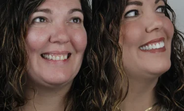 image for before and after