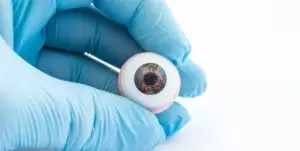 Artificial Eye Creation & Fitting in Dubai, United Arab Emirates by Moorfields Eye Hospital