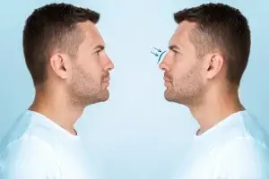 Best Countries for Rhinoplasty in the World