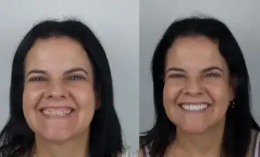 images for before and after