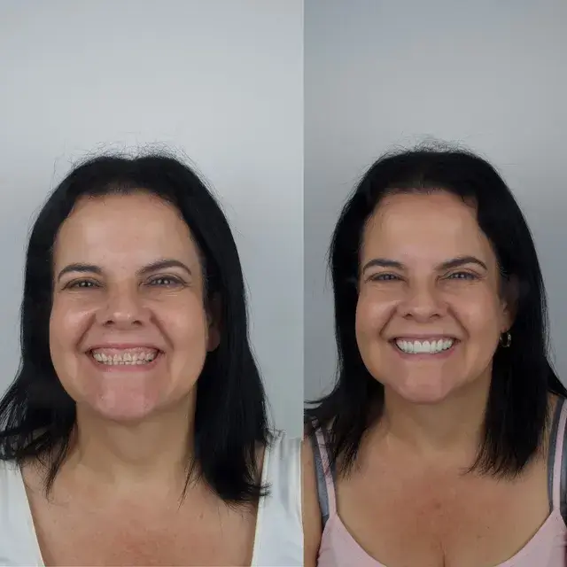 images for before and after