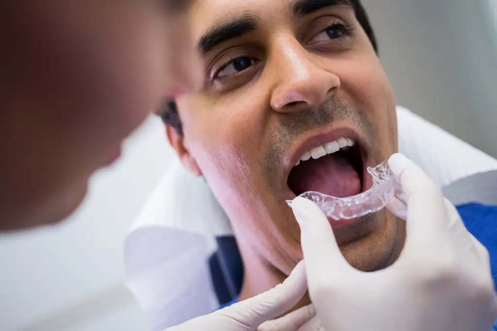 Aligners candidate