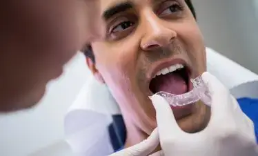 Aligners candidate