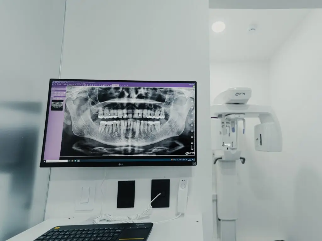 All on 6 Zirconia (Per Arch) in San Rafael, Costa Rica by Aesthetic Dental Clinic — Dentistry Procedure in Costa Rica