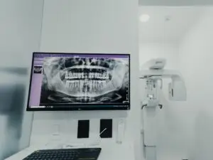 All on 6 Zirconia (Per Arch) in San Rafael, Costa Rica by Aesthetic Dental Clinic at Aesthetic Dental Care — Dentistry Procedure Abroad