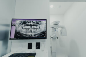 All on 6 Zirconia (Per Arch) in San Rafael, Costa Rica by Aesthetic Dental Clinic — Dentistry in Costa Rica