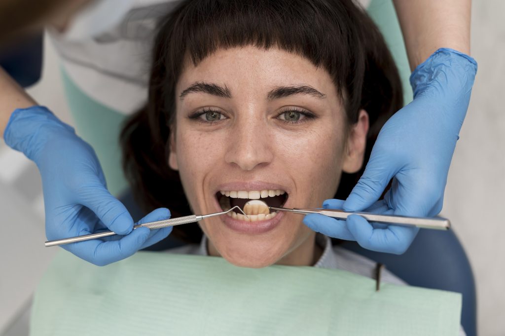 general image for candidate of all on 4 implant
