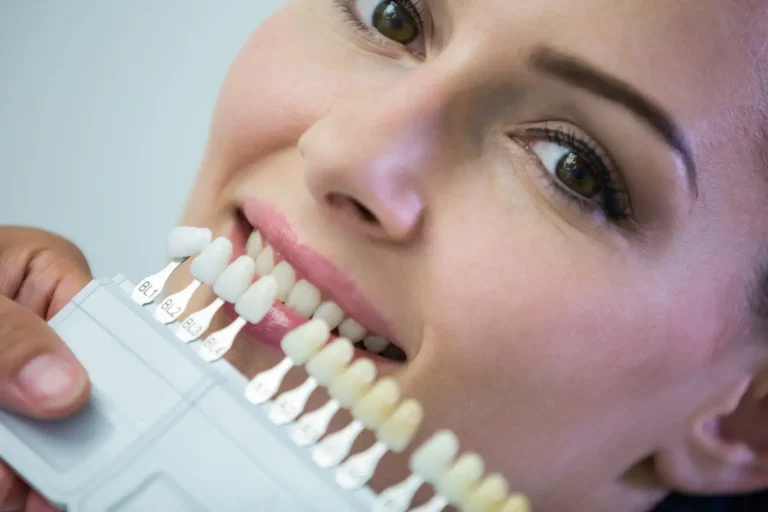 Full mouth Dental Veneers Cost in Mexico