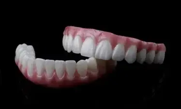dental implant