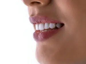 Bone Grafting in San Rafael, Costa Rica by Aesthetic Dental Clinic at Aesthetic Dental Care — Dentistry Procedure Abroad