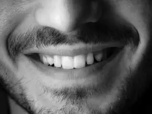 Dental Crown in San Rafael, Costa Rica by Aesthetic Dental Clinic — Dentistry in Costa Rica