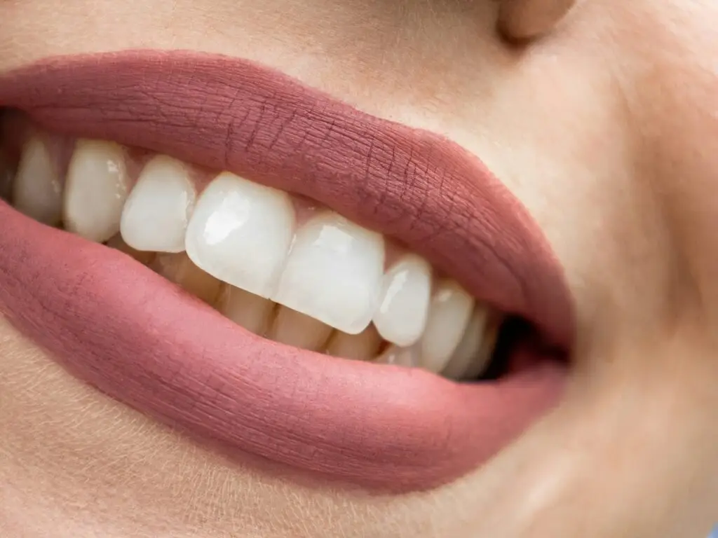 Gingivoplasty (Gum Contouring) in San Rafael, Costa Rica by Aesthetic Dental Clinic — Dentistry Procedure in Costa Rica