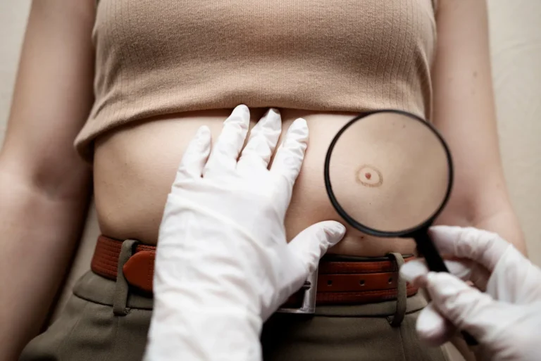 Cyst Removal Surgery Cost Without Insurance