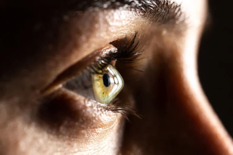 Laser Eye Surgery in Dubai, United Arab Emirates by Moorfields Eye Hospital — Ophthalmology Procedure in UAE: Dubai