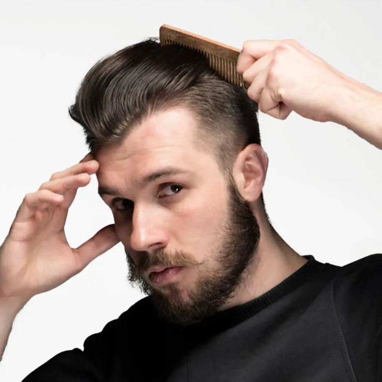 FUE Hair Transplantation in Istanbul, Turkey by Memorial Hospital
