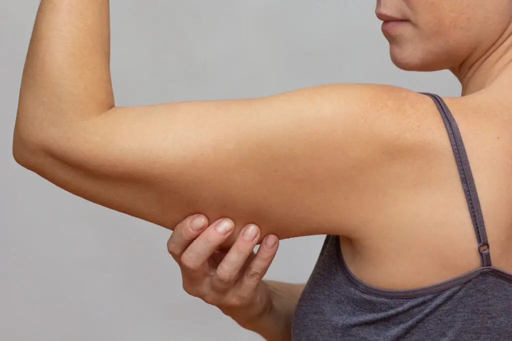 Arm Lift in Istanbul, Turkey by Memorial Hospital — Plastic Surgery Procedure in Turkey