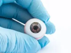 Artificial Eye Creation & Fitting in Dubai, United Arab Emirates by Moorfields Eye Hospital — Ophthalmology in UAE: Dubai