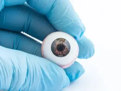Artificial Eye Creation & Fitting in Dubai, United Arab Emirates by Moorfields Eye Hospital — Ophthalmology Procedure in UAE: Dubai
