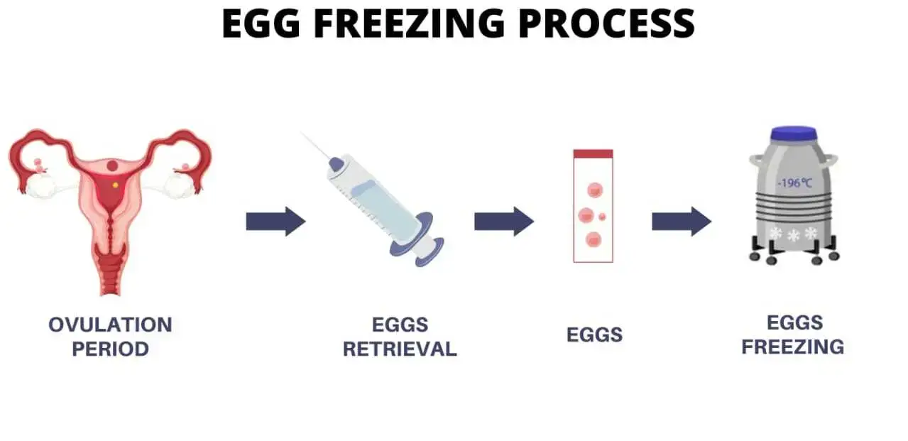 Egg Freezing in Athens, Greece by Ovagenesis — Procedure Gallery Photo