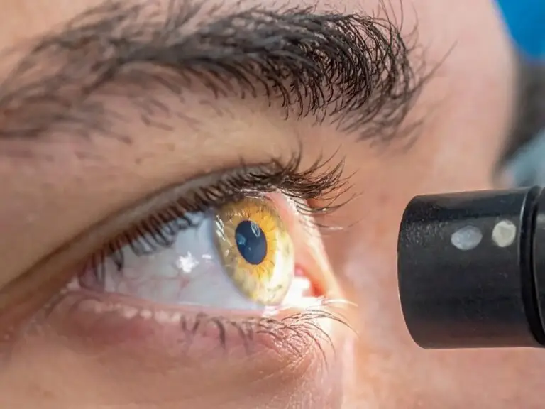 Posterior Vitreous Detachment (PVD) in Dubai, United Arab Emirates by Moorfields Eye Hospital — Ophthalmology Procedure in UAE: Dubai