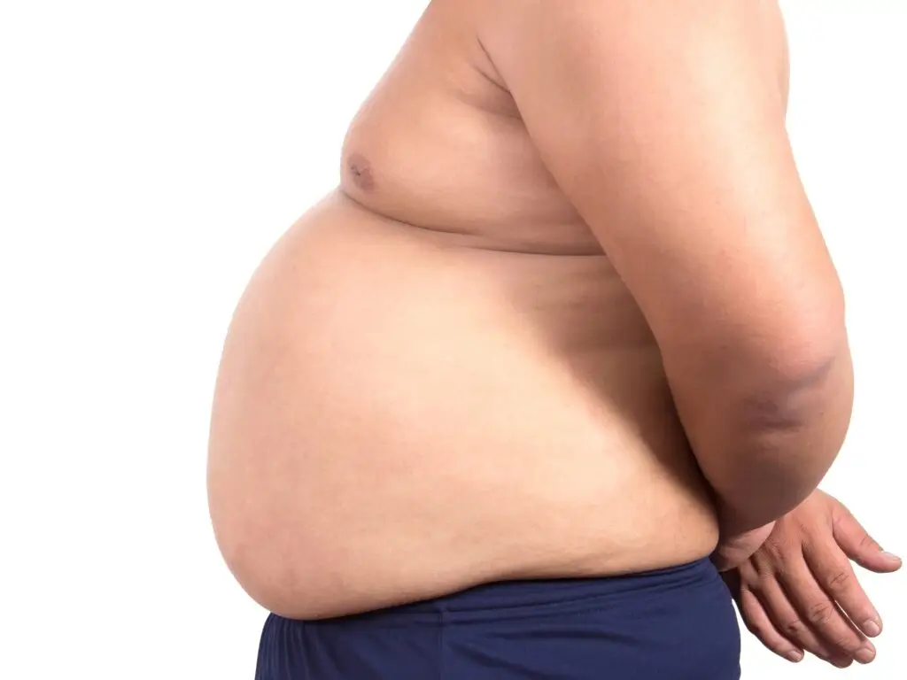 Gastric Sleeve Surgery in Istanbul, Turkey by Memorial Hospital — Weight Loss Surgery Procedure in Turkey