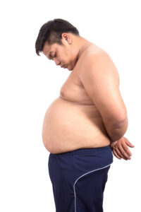Gastric Sleeve Surgery in Istanbul, Turkey by Memorial Hospital — Weight Loss Surgery in Turkey