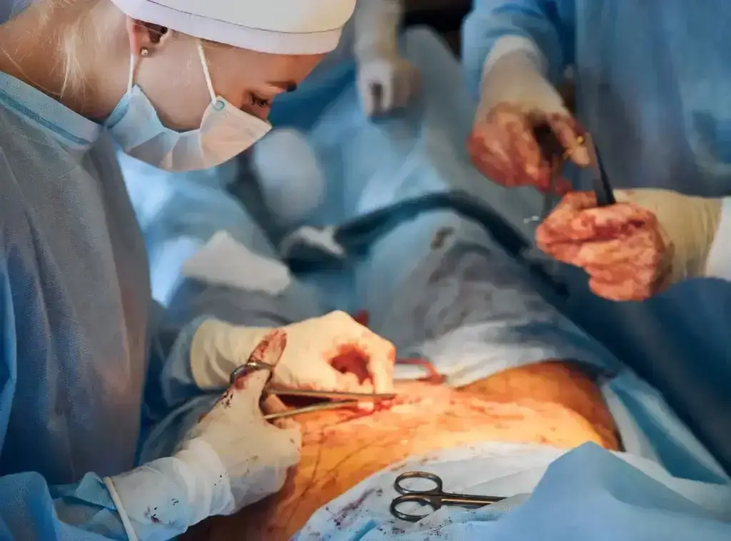 How Much Does Gallbladder Surgery Cost Without Insurance?