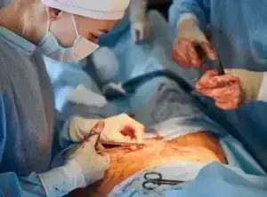 How Much Does Gallbladder Surgery Cost Without Insurance?