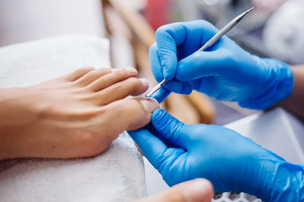 Ingrown Toenail Surgery Cost Without Insurance