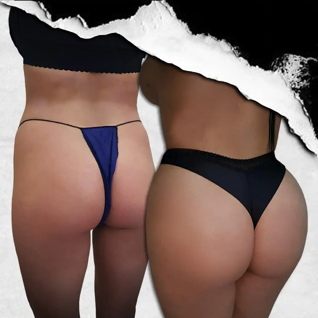 Brazilian Butt Lift in Istanbul, Turkey by International Plus