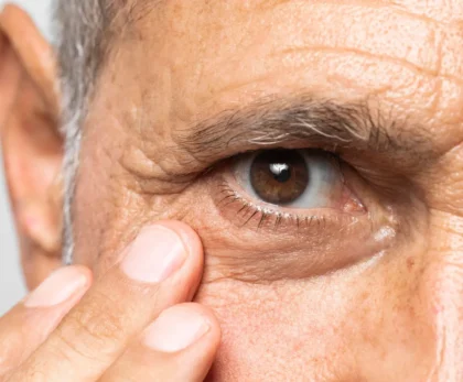 Glaucoma Surgery Cost Without Insurance