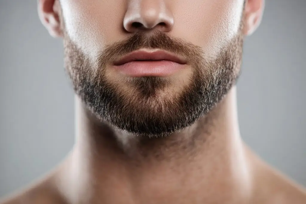Beard Transplantation in Istanbul, Turkey by Memorial Hospital — Hair Restoration Surgery Procedure in Turkey