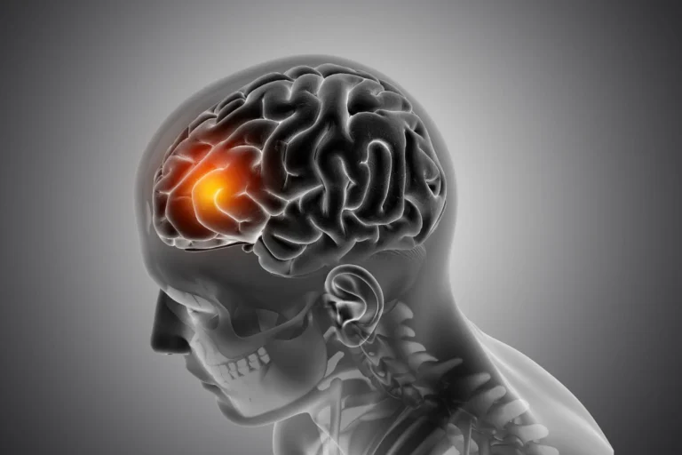 Brain Tumor Surgery Cost Without Insurance — Medical Tourism Guide
