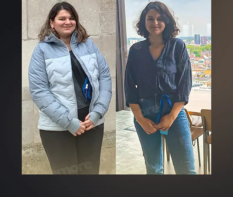 Gastric Balloon in Istanbul, Turkey by Memorial Hospital — Procedure Gallery Photo