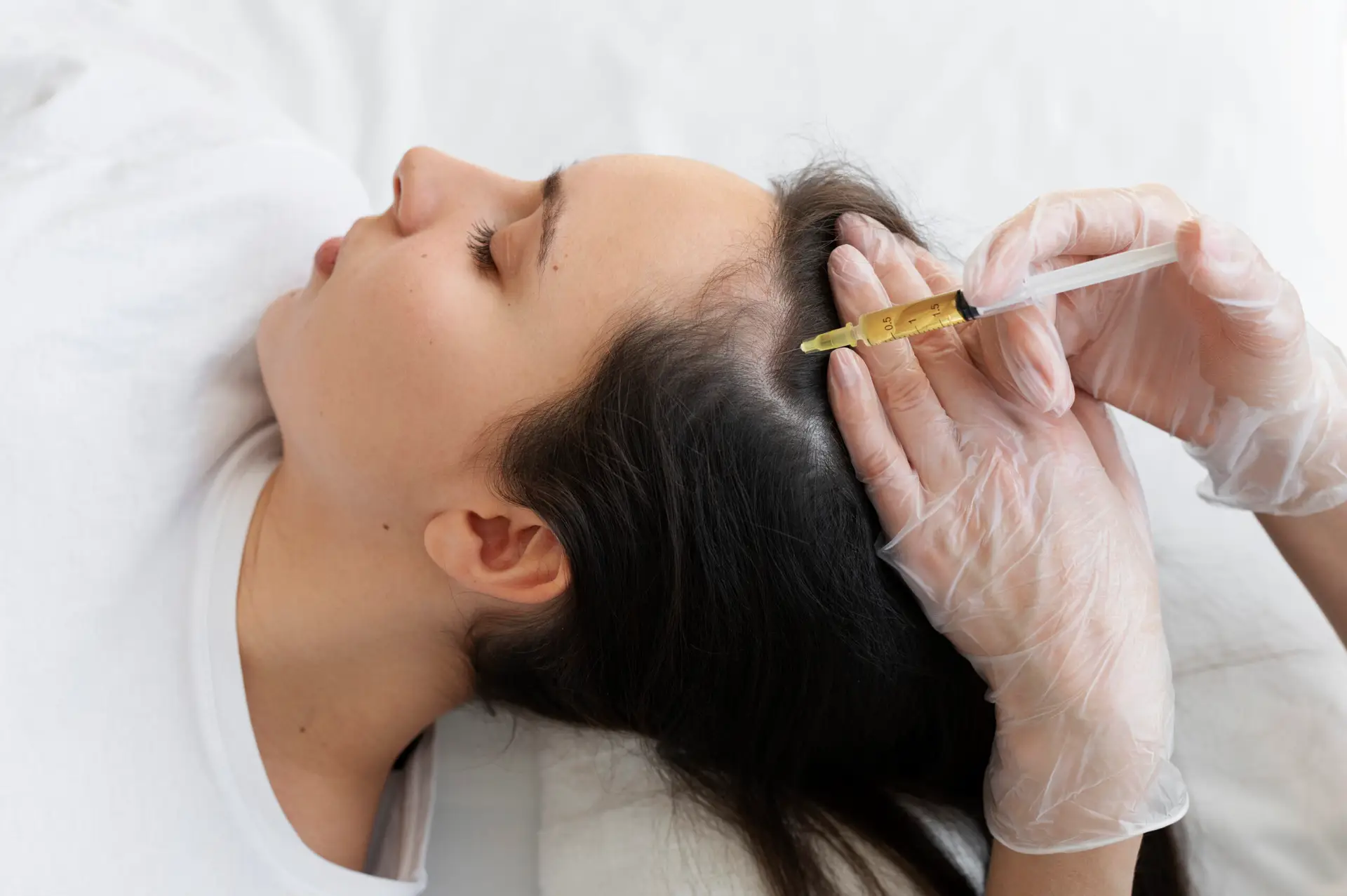 Stem Cell Hair Transplant in Istanbul, Turkey by Memorial Hospital — Procedure Gallery Photo