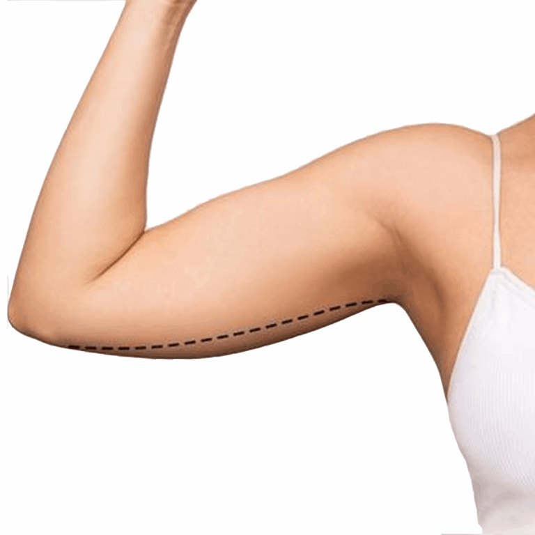 Arm Lift in Bangkok, Thailand by Wansiri Hospital