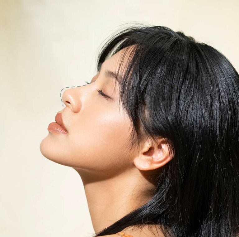 Closed Rhinoplasty in Bangkok, Thailand by Wansiri Hospital
