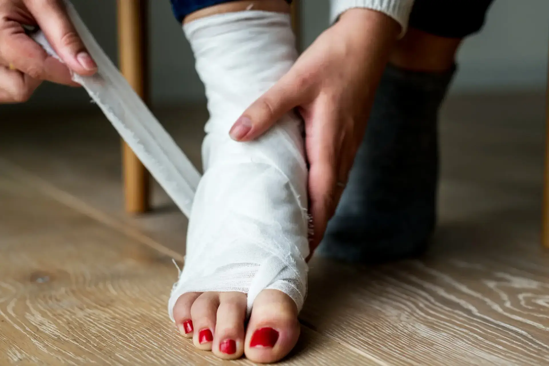 How Much Does a Broken Foot Cost Without Insurance