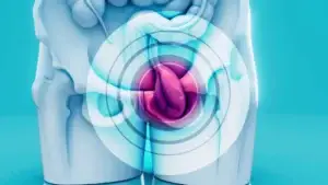Laparoscopic Surgery Cost Without Insurance