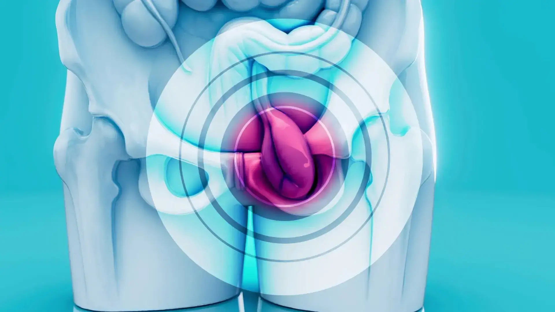 Laparoscopic Surgery Cost Without Insurance