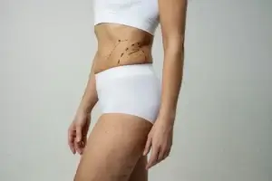Liposuction in Colombia Cost and Clinics