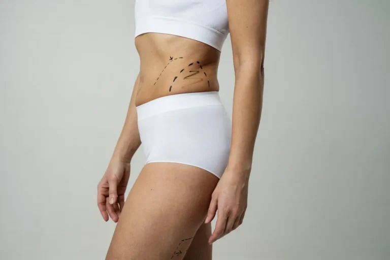 Liposuction in Colombia Cost and Clinics